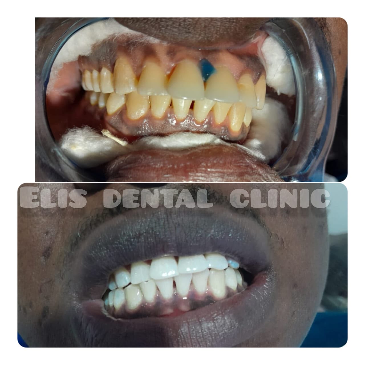 Bright healthy smile